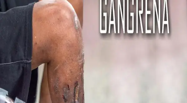 Fragment nogi z widocznymi ranami i tekstem "GANGRENA".