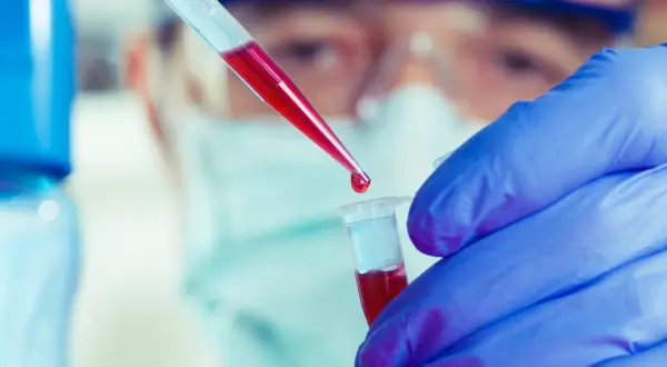 Jak długo jest ważne skierowanie do laboratorium? Uniknij problemów z ważnością