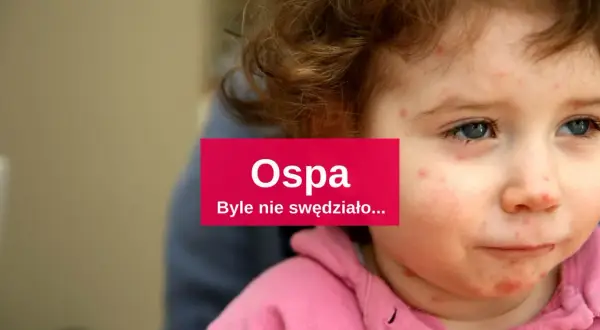 Jakie leki na ospę u dzieci? Skuteczne metody łagodzenia objawów