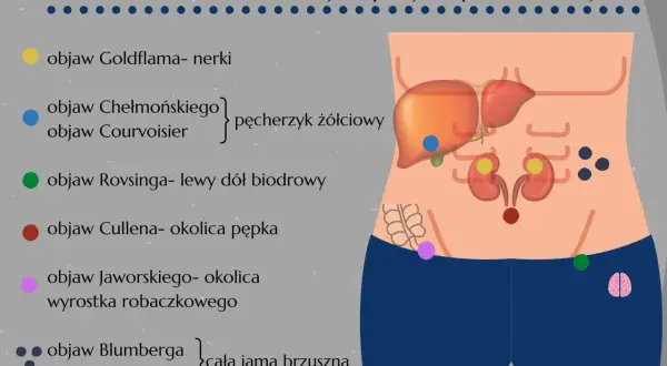 Objaw Jaworskiego lokalizuje się w okolicy wyrostka robaczkowego, zaznaczony na różowo na schemacie jamy brzusznej.