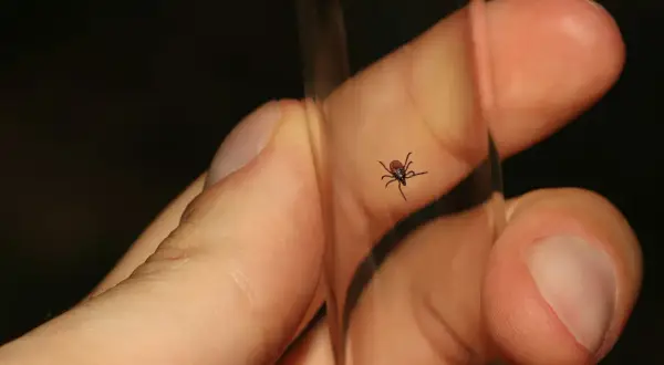 Kleszcz na palcu, symbol zagrożenia boreliozą. Szybka diagnoza i borelioza leczenie to klucz do zdrowia.