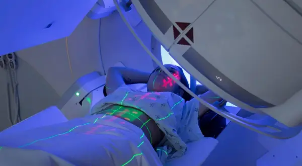 Pacjentka leży pod aparatem do radioterapii, na jej ciele widoczne są zielone i czerwone linie naprowadzające.