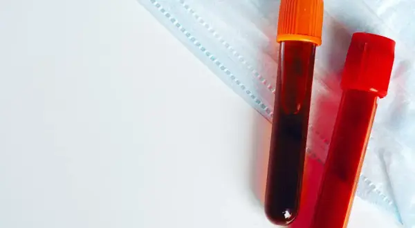 Dwie probówki z krwią na tle maseczki medycznej. Badanie krwi, np. egfr co to, może pomóc w diagnostyce.