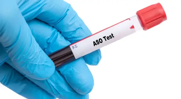 Ręka w niebieskiej rękawiczce trzyma probówkę z napisem "ASO Test".