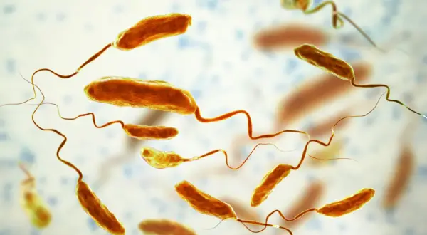 Mikroskopijny obraz bakterii cholery (Vibrio cholerae) z charakterystycznymi wiciami.