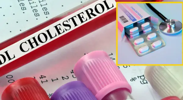 Czy leki na cholesterol odchudzają? Sprawdź, co mówią badania