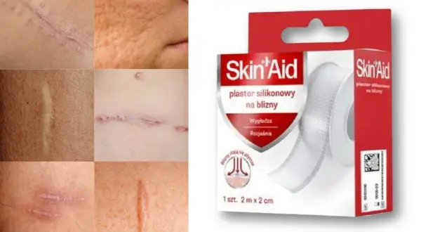 Skin Aid plastry na blizny: Opinie, recenzja i efekty