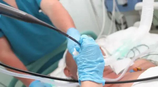 Lekarz w niebieskich rękawiczkach wykonuje bronchoskopię, wprowadzając endoskop do dróg oddechowych pacjenta.