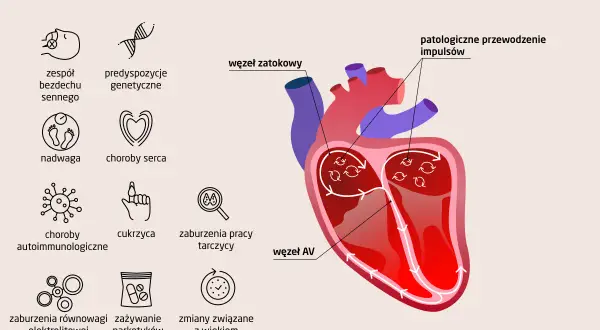 Ilustracja przedstawia przyczyny arytmii serca: bezdech senny, predyspozycje genetyczne, nadwagę, choroby serca, choroby autoimmunologiczne, cukrzycę, zaburzenia pracy tarczycy, zaburzenia elektrolitowe, narkotyki i wiek.