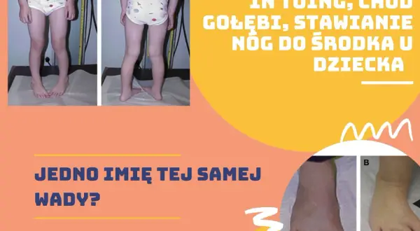 Gołębi chód u dzieci: przyczyny, objawy i skuteczne leczenie