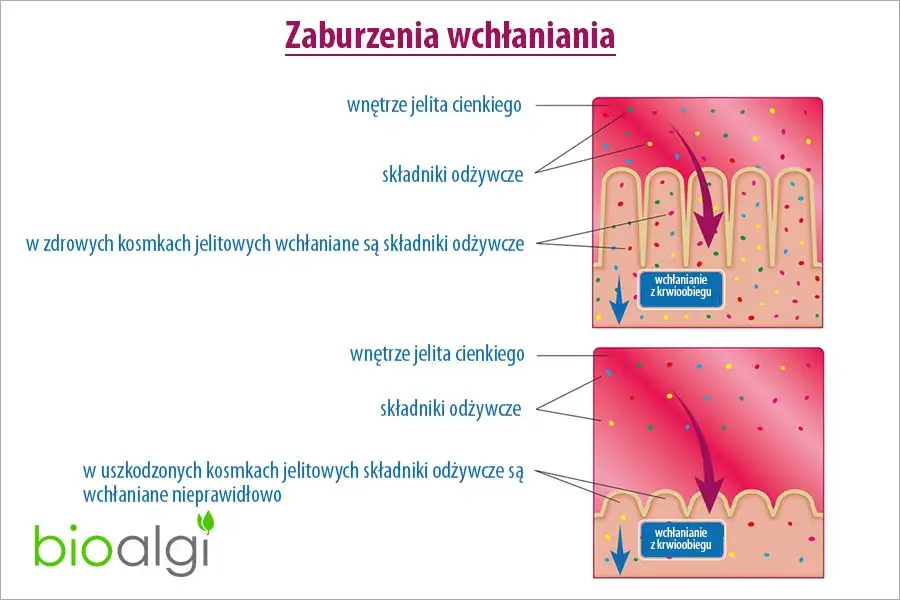 Objawy zaburzeń wchłaniania – jak rozpoznać i co może je powodować?
