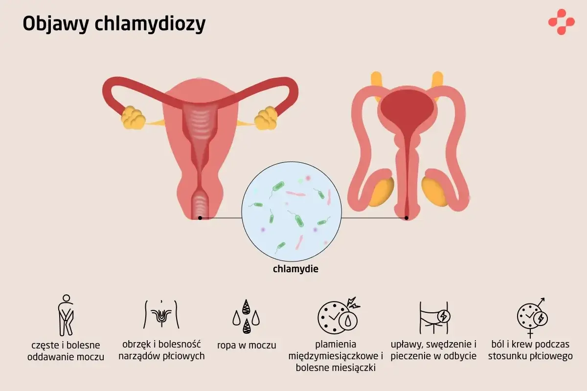 Ilustracja przedstawia układ rozrodczy kobiety i mężczyzny, z powiększeniem ukazującym bakterie chlamydii. Wymienione są objawy chlamydiozy: ból przy oddawaniu moczu, obrzęk narządów płciowych, ropa w moczu, plamienia, upławy i ból podczas stosunku.