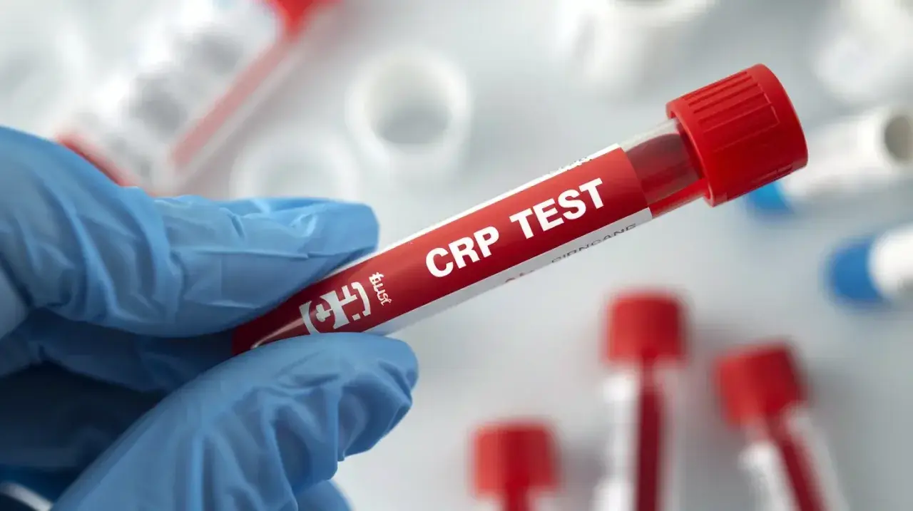 Rękawiczka trzyma probówkę z krwią do badania CRP. Cena tego testu jest kluczowa dla diagnostyki.