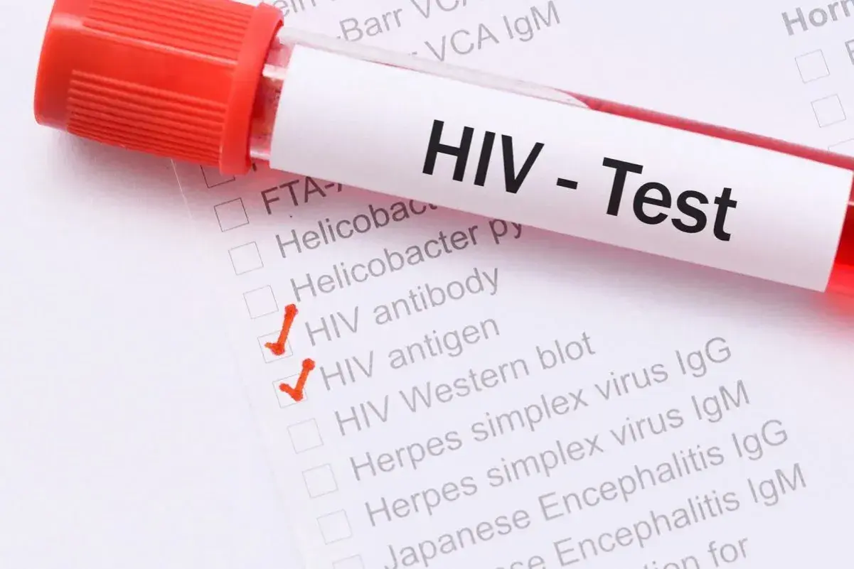 Próbówka z krwią do testu HIV. Zaznaczone pozycje "HIV antibody" i "HIV antigen" mogą być istotne w diagnostyce objawów u mężczyzn.