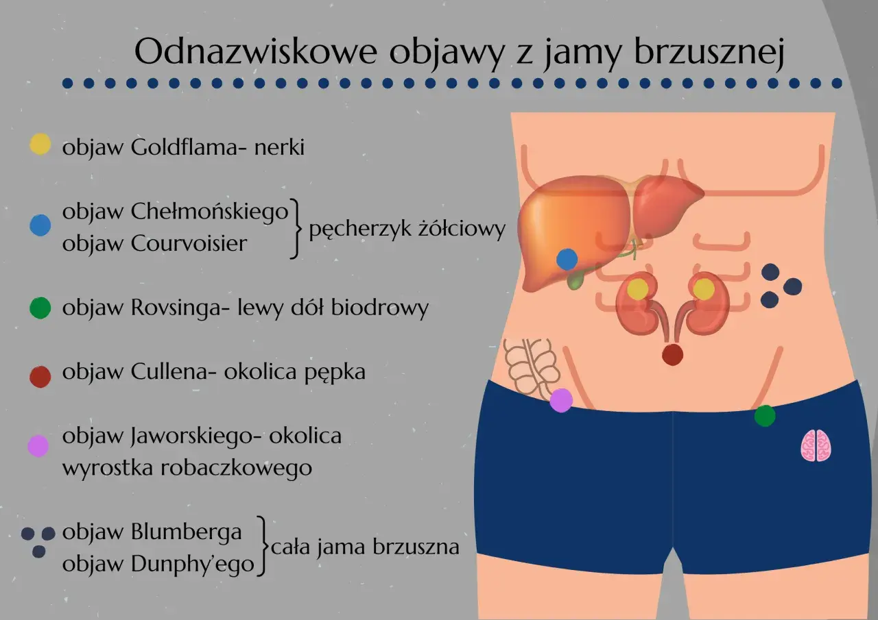 Objaw Jaworskiego lokalizuje się w okolicy wyrostka robaczkowego, zaznaczony na różowo na schemacie jamy brzusznej.