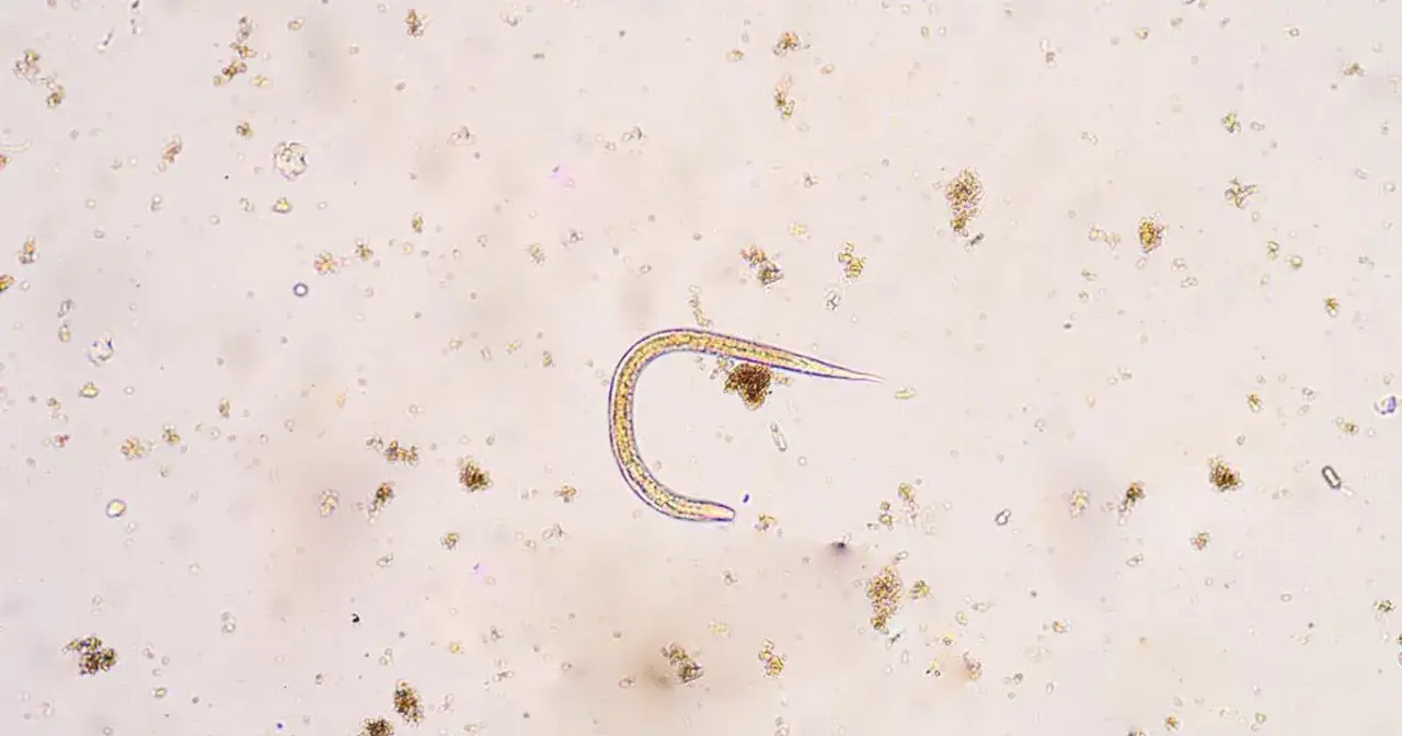 Mikroskopowy obraz nicienia w próbce, otoczony drobnymi cząstkami.