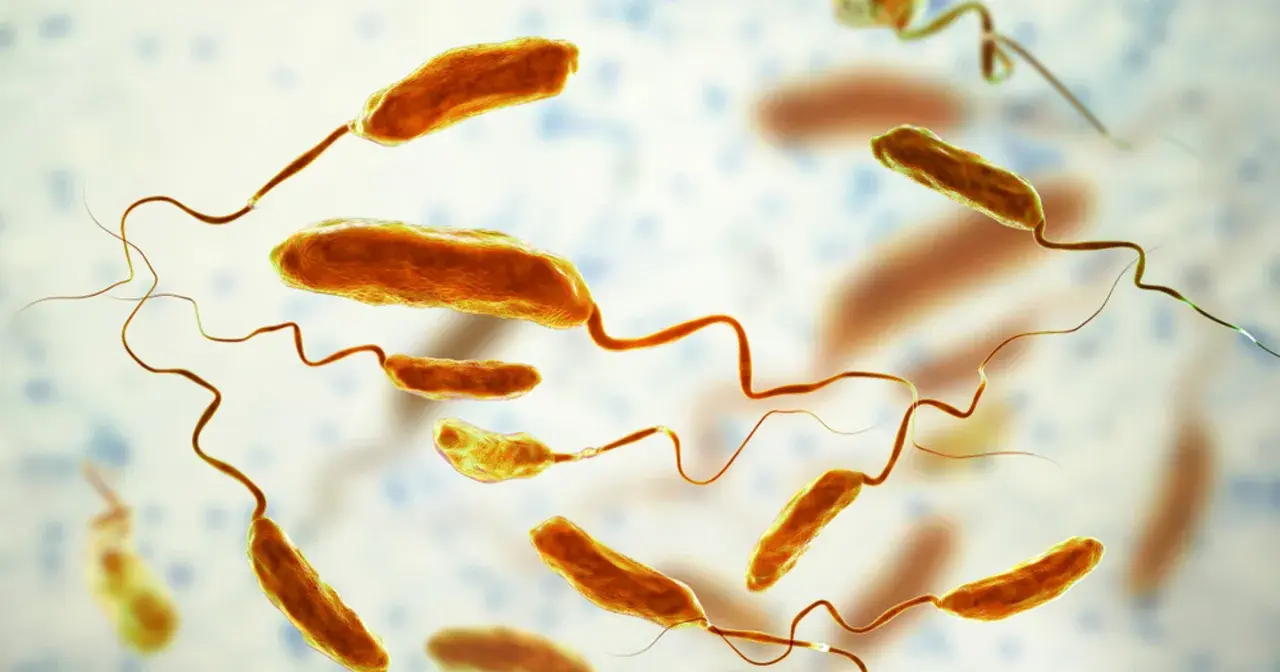 Mikroskopijny obraz bakterii cholery (Vibrio cholerae) z charakterystycznymi wiciami.