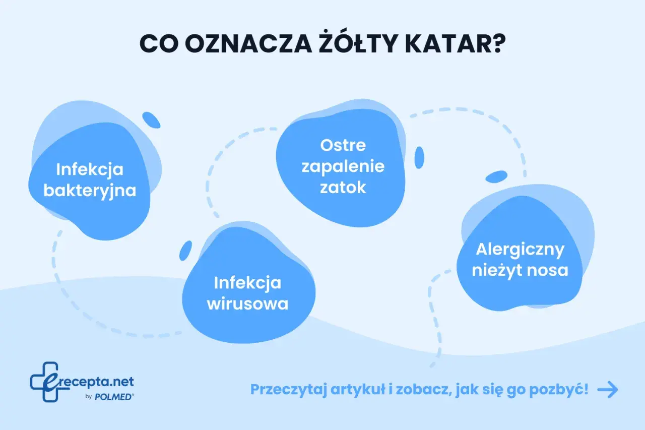 Grafika przedstawia schemat przyczyn żółtego kataru: infekcja bakteryjna, wirusowa, ostre zapalenie zatok, alergiczny nieżyt nosa.