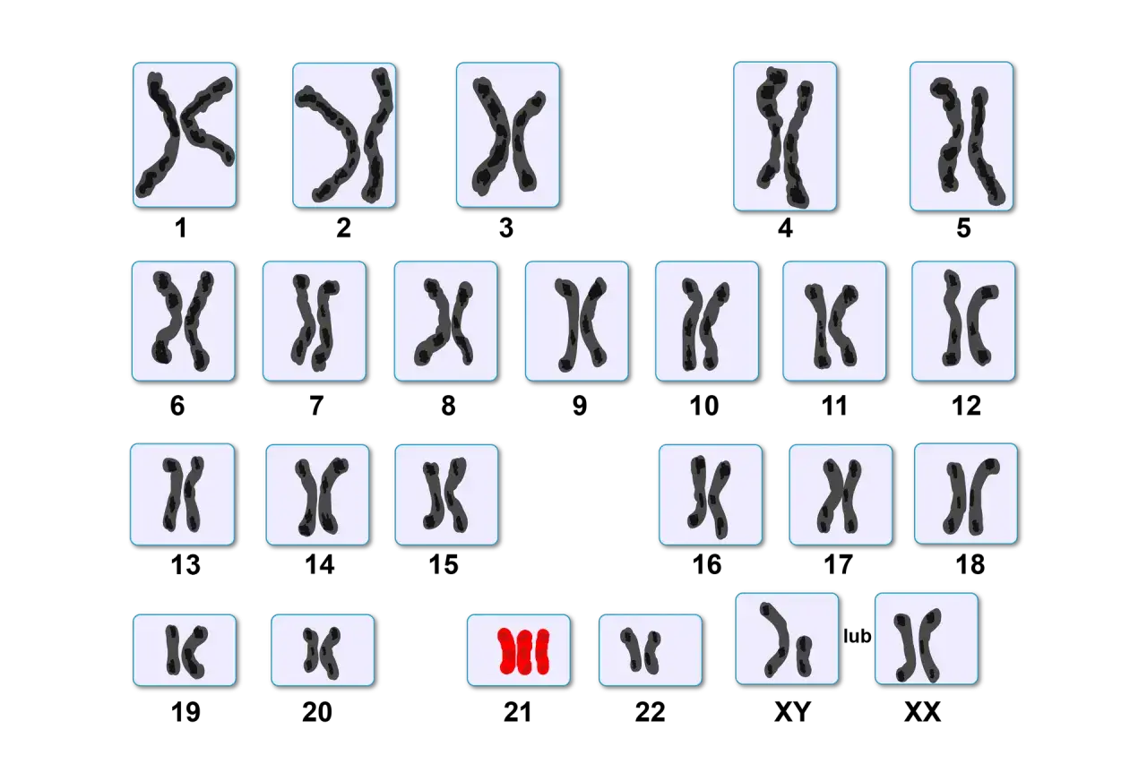Zestawienie różnych par chromosomów, w tym jedna nieprawidłowa triada.
