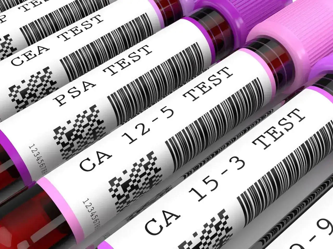 Rurki z próbkami krwi do badań: CEA, PSA, CA 12-5, CA 15-3. To co to za badanie?