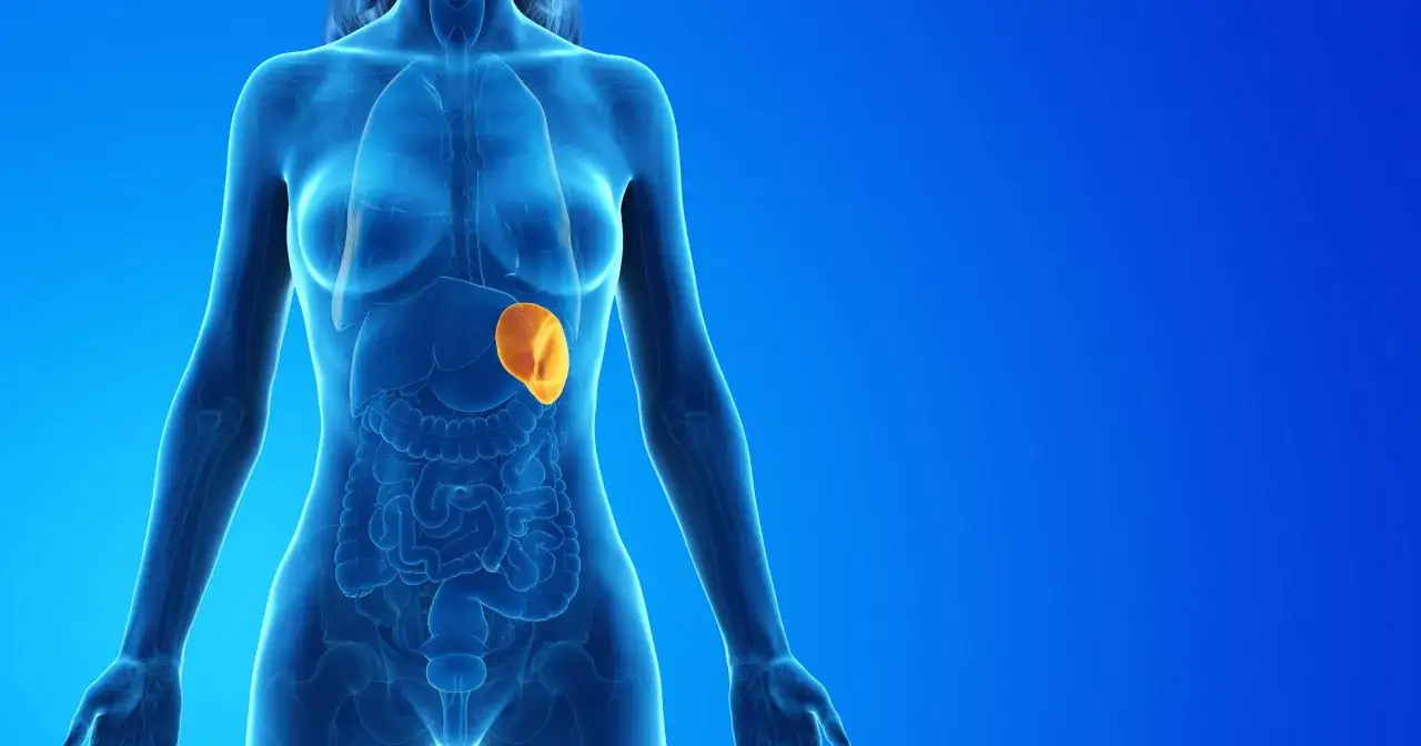 Anatomical illustration of a female torso showing internal organs. The spleen, highlighted in orange, appears enlarged, indicating a potential medical condition.