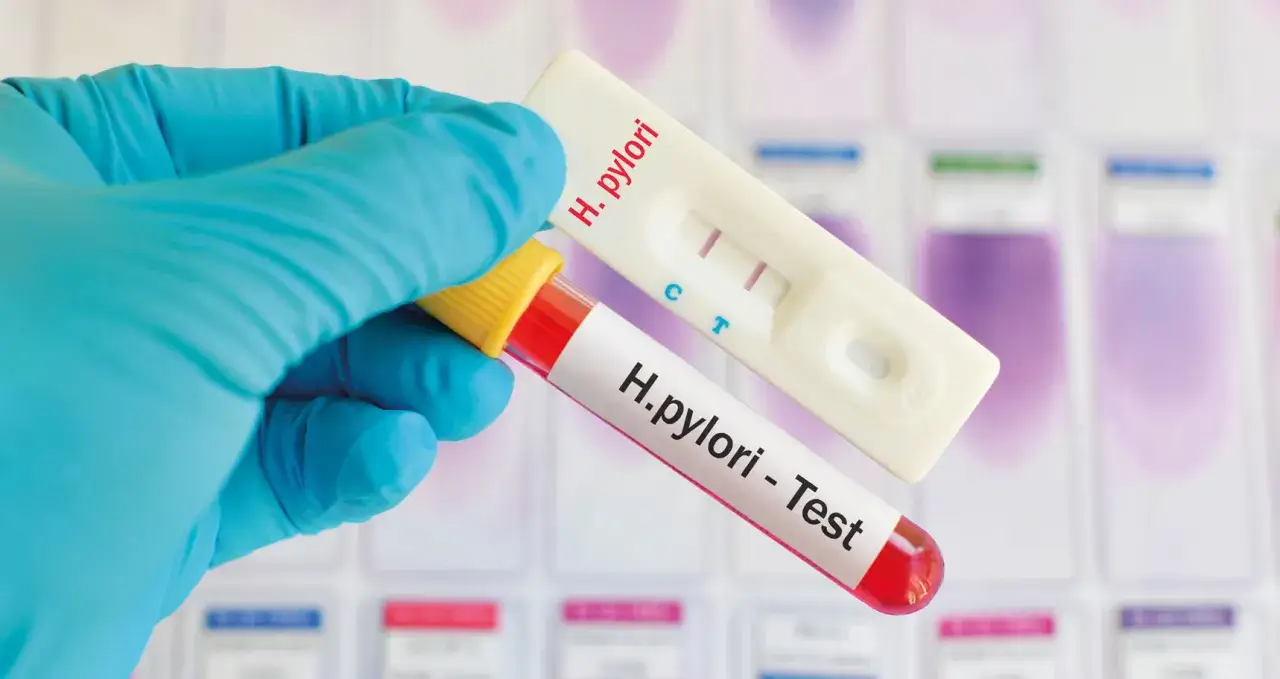 Rękawiczka trzyma probówkę z krwią i test H. pylori. Wynik testu ureazowego jest pozytywny.