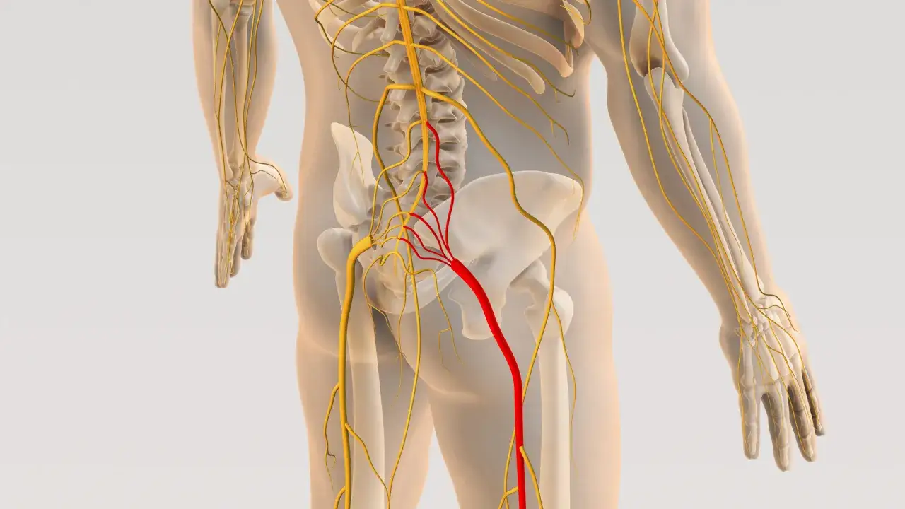 Anatomia układu nerwowego, z zaznaczonym na czerwono nerwem kulszowym, który może być objęty zapaleniem krążka międzykręgowego.