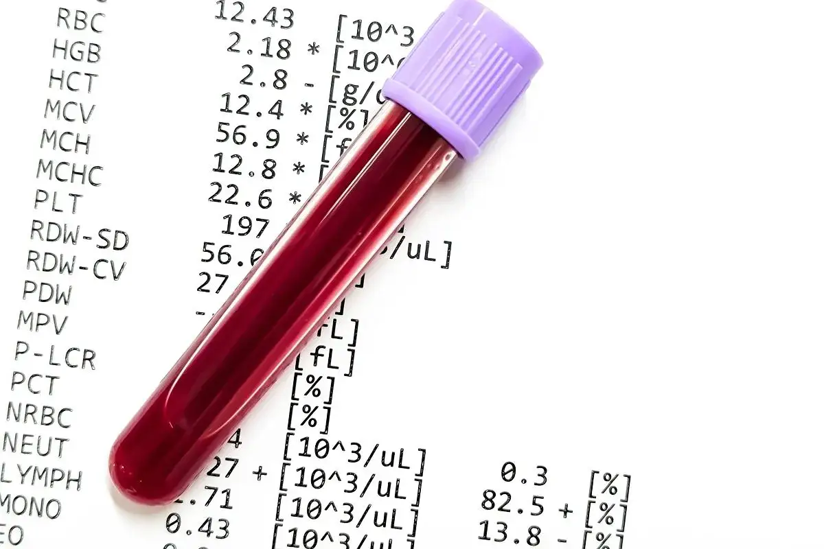 Probówka z krwią na tle wyników badań laboratoryjnych. Wyniki analizy krwi, w tym RBC, HGB, HCT, MCV, MCH, MCHC, PLT, RDW-SD, RDW-CV, PDW, MPV, P-LCR, PCT, NRBC, NEUT, LYMPH, MONO, EO.