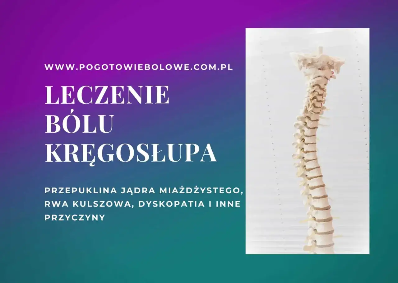 Model kręgosłupa, tekst o leczeniu bólu kręgosłupa, przepuklinie jądra miażdżystego, rwie kulszowej, dyskopatii i innych przyczynach. Zapalenie krążka międzykręgowego objawy.