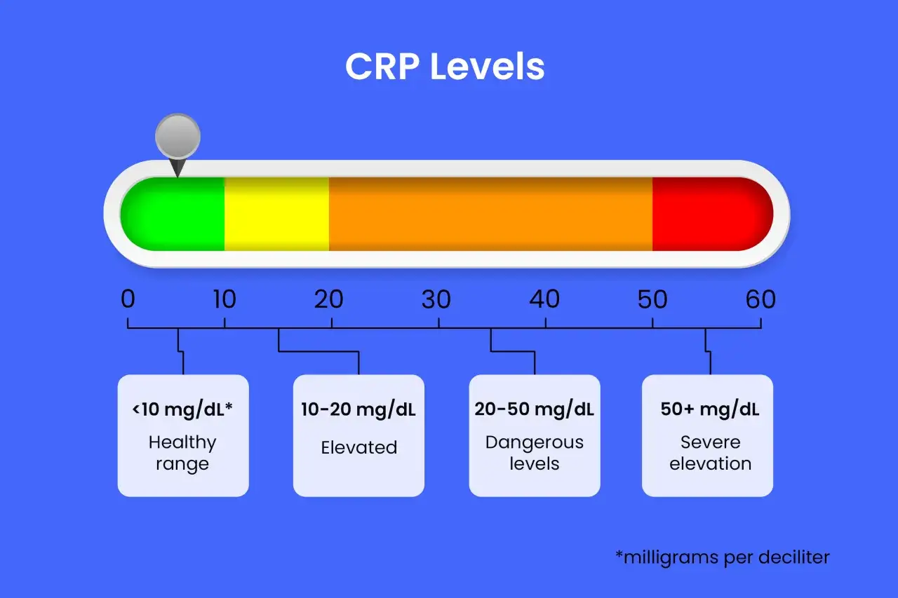 Wykres poziomu CRP: <10 mg/dL to norma, 10-20 mg/dL to podwyższony poziom, 20-50 mg/dL to niebezpieczne stężenie, a powyżej 50 mg/dL to ciężkie podwyższenie.