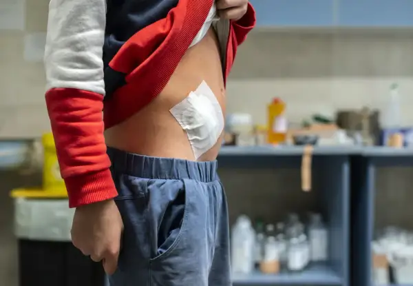 Dziecko z opatrunkiem na brzuchu po operacji.