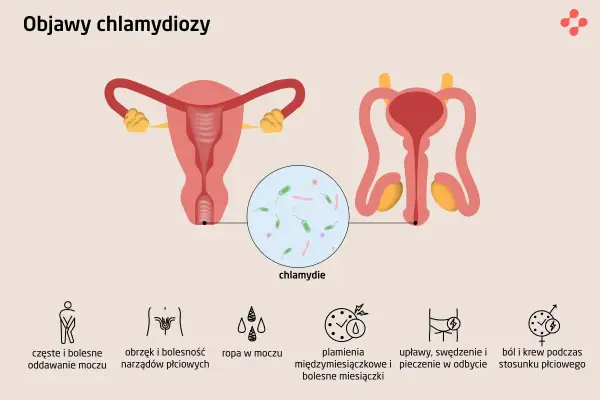 Ilustracja przedstawia układ rozrodczy kobiety i mężczyzny, z powiększeniem ukazującym bakterie chlamydii. Wymienione są objawy chlamydiozy: ból przy oddawaniu moczu, obrzęk narządów płciowych, ropa w moczu, plamienia, upławy i ból podczas stosunku.