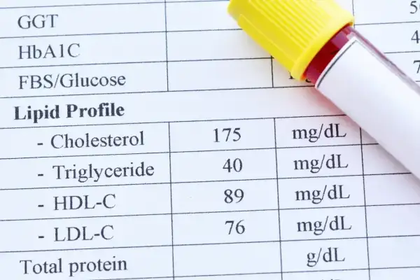 Wynik lipidogramu: cholesterol całkowity 175 mg/dL, HDL 89 mg/dL, LDL 76 mg/dL. Wartość cholesterolu nie-HDL jest kluczowa dla oceny ryzyka sercowo-naczyniowego.