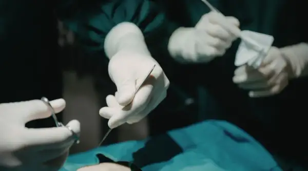 Dłonie chirurga w rękawiczkach trzymające narzędzia chirurgiczne i gazę podczas operacji.