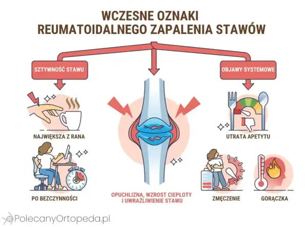 Wczesne objawy reumatoidalnego zapalenia stawów: sztywność, opuchlizna, utrata apetytu, zmęczenie, gorączka.