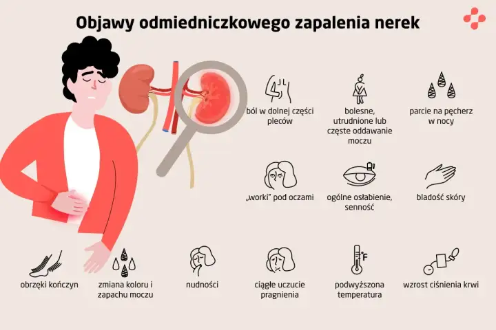 Zapalenie nerek - objawy, które musisz znać. Kiedy do lekarza?