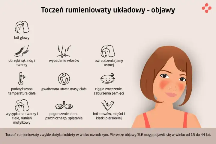 Toczeń rumieniowaty układowy - pierwsze objawy i sygnały alarmowe
